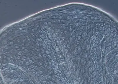 3 ZEISS Primo Star 3 Célula negra fluorescente vista a través de zeiss primostar 3, Microscopios en Guadalajara